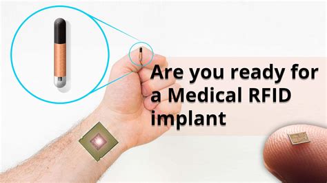 rfid chip human tracking|Human Microchipping: An Unbiased Look at the Pros and Cons.